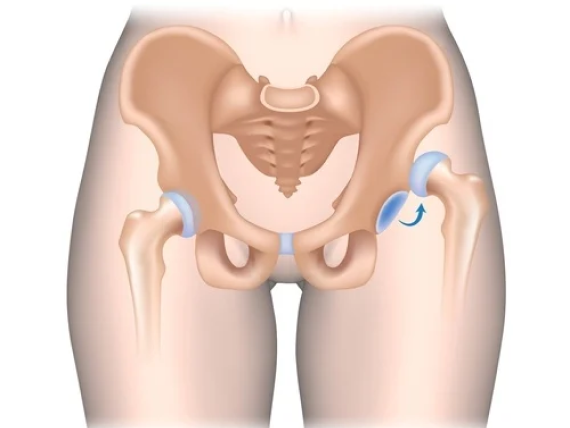 Hip Pain Treatment in Ahmedabad